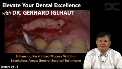 Enhancing keratinized mucosa width in edentulous areas: General surgical techniques
